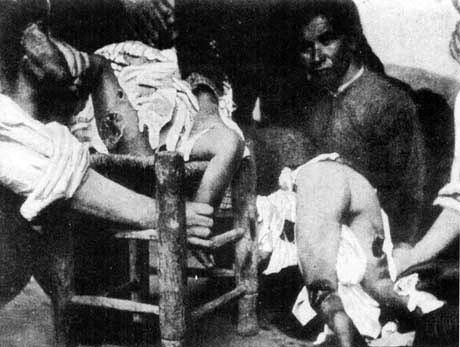 Армянские дети из Аданы. Фото с выставки